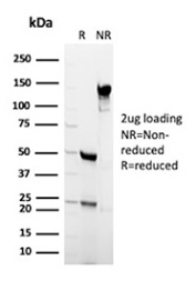 SDS-PAGE Analysis of Purified, BSA-Free ACE2 Antibody (clone ACE2/7203). Confirmation of Integrity and Purity of the Antibody.