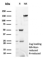 SDS-PAGE analysis of purified, BSA-free S100G antibody (clone S100G/7462) as confirmation of integrity and purity.