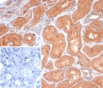 IHC staining of FFPE human kidney tissue with S100G antibody (clone S100G/7462). Inset: PBS used in place of primary Ab (secondary Ab negative control). HIER: boil tissue sections in pH 9 10mM Tris with 1mM EDTA for 20 min and allow to cool before testing.