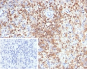 IHC staining of FFPE human spleen tissue with Calbindin D9K antibody (clone S100G/7516). Inset: PBS used in place of primary Ab (secondary Ab negative control). HIER: boil tissue sections in pH 9 10mM Tris with 1mM EDTA for 20 min and allow to cool before testing.