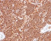 IHC staining of FFPE human lymph node tissue with Calbindin D9Kantibody (clone S100G/7516). HIER: boil tissue sections in pH 9 10mM Tris with 1mM EDTA for 20 min and allow to cool before testing.