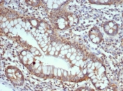 IHC staining of FFPE human small intestine tissue with Calbindin D9K antibody (clone S100G/7516). HIER: boil tissue sections in pH 9 10mM Tris with 1mM EDTA for 20 min and allow to cool before testing.