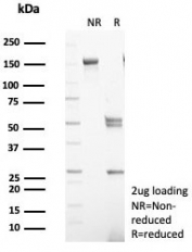SDS-PAGE analysis of purified, BSA-free Calbindin D9K antibody (clone S100G/7516) as confirmation of integrity and purity.