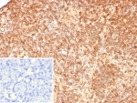 IHC staining of FFPE human lymph node tissue with Calbindin D9K antibody (clone S100G/7517). Inset: PBS used in place of primary Ab (secondary Ab negative control). HIER: boil tissue sections in pH 9 10mM Tris with 1mM EDTA for 20 min and allow to cool before testing.