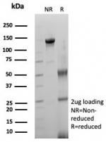 SDS-PAGE analysis of purified, BSA-free ACE2 / CD143 antibody (clone ACE2/8748R) as confirmation of integrity and purity.