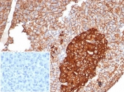 IHC staining of FFPE human pancreas tissue with CD99 antibody (clone MIC2/7865). Inset: PBS used in place of primary Ab (secondary Ab negative control). HIER: boil tissue sections in pH 9 10mM Tris with 1mM EDTA for 20 min and allow to cool before testing.