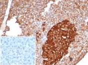 IHC staining of FFPE human pancreas tissue with CD99 antibody (clone MIC2/7865). Inset: PBS used in place of primary Ab (secondary Ab negative control). HIER: boil tissue sections in pH 9 10mM Tris with 1mM EDTA for 20 min and allow to cool before testing.