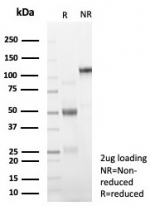 SDS-PAGE analysis of purified, BSA-free GPC3 antibody (clone GPC3/8363R) as confirmation of integrity and purity.