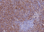 IHC staining of FFPE human pancreas tissue with CD99 antibody (clone MIC2/7867). HIER: boil tissue sections in pH 9 10mM Tris with 1mM EDTA for 20 min and allow to cool before testing.
