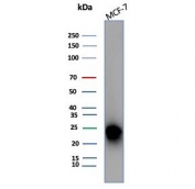 Western blot testing of human MCF-7 cell lysate with CD99 antibody (clone MIC2/7867). Predicted molecular weight: 16-32 kDa depending on the level of glycosylation.
