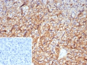 IHC staining of FFPE human pancreas tissue with CD99 antibody (clone MIC2/7861). Inset: PBS used in place of primary Ab (secondary Ab negative control). HIER: boil tissue sections in pH 9 10mM Tris with 1mM EDTA for 20 min and allow to cool before testing.