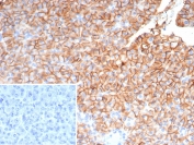 IHC staining of FFPE human pancreas tissue with CD99 antibody (clone MIC2/7862). Inset: PBS used in place of primary Ab (secondary Ab negative control). HIER: boil tissue sections in pH 9 10mM Tris with 1mM EDTA for 20 min and allow to cool before testing.