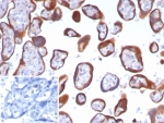 IHC staining of FFPE human placental tissue with Glypican-3 antibody (clone GPC3/8148R). Inset: PBS used in place of primary Ab (secondary Ab negative control). HIER: boil tissue sections in pH 9 10mM Tris with 1mM EDTA for 20 min and allow to cool before testing.