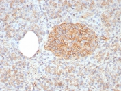 IHC staining of FFPE human pancreas tissue with CD99 antibody (clone rMIC2/8358). HIER: boil tissue sections in pH 9 10mM Tris with 1mM EDTA for 20 min and allow to cool before testing.
