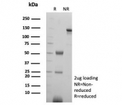 SDS-PAGE analysis of purified, BSA-free CD99 antibody (clone rMIC2/8746) as confirmation of integrity and purity.