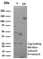 SDS-PAGE analysis of purified, BSA-free AR antibody (clone rDHTR/8818) as confirmation of integrity and purity.