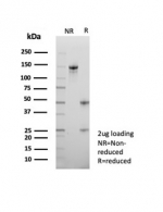 SDS-PAGE analysis of purified, BSA-free ATRX antibody (clone ATRX/7940) as confirmation of integrity and purity.