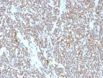 IHC staining of FFPE human colon tissue with ATRX antibody (clone ATRX/7940). HIER: boil tissue sections in pH 9 10mM Tris with 1mM EDTA for 20 min and allow to cool before testing.