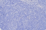 Negative control: IHC testing of FFPE human brain tissue with GPC3 antibody (clone GPC3/8127R) at 2ug/ml. HIER: boil tissue sections in pH 9 10mM Tris with 1mM EDTA for 20 min and allow to cool before testing.