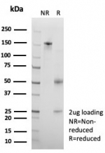 SDS-PAGE analysis of purified, BSA-free CD99 antibody (clone rMIC2/8497) as confirmation of integrity and purity.