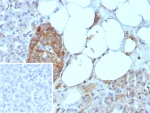 IHC staining of FFPE human pancreas tissue with CD99 antibody (clone rMIC2/8497). Inset: PBS used in place of primary Ab (secondary Ab negative control). HIER: boil tissue sections in pH 9 10mM Tris with 1mM EDTA for 20 min and allow to cool before testing.