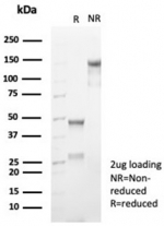 SDS-PAGE analysis of purified, BSA-free CD99 antibody (clone rMIC2/6939) as confirmation of integrity and purity.