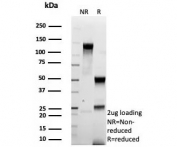 SDS-PAGE analysis of purified, BSA-free recombinant HER-2 antibody (clone rERBB2/9401) as confirmation of integrity and purity.