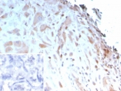 IHC staining of FFPE human placenta tissue with Insulin-like growth factor-binding protein 3 antibody (clone IGFBP3/3423). Inset: PBS used in place of primary Ab (secondary Ab negative control).