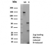 SDS-PAGE analysis of purified, BSA-free IL-2 antibody (clone IL2/9007) as confirmation of integrity and purity.