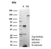SDS-PAGE analysis of purified, BSA-free recombinant Epstein-Barr Virus antibody (clone EBV/9619R) as confirmation of integrity and purity.