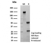 SDS-PAGE analysis of purified, BSA-free recombinant TAG-72 antibody (clone rTAG72/9132) as confirmation of integrity and purity.