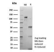 SDS-PAGE analysis of purified, BSA-free recombinant Cadherin 16 antibody (clone CDH16/9611R) as confirmation of integrity and purity.