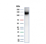 Western blot testing of human kidney tissue lysate using recombinant Cadherin 16 antibody (clone CDH16/9611R).