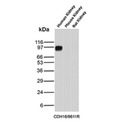 Cadherin 16 Antibody Human Kidney WB. Western blot analysis of Cadherin-16 / CDH16 expression across kidney tissue lysates using Cadherin 16 antibody clone CDH16/9611R. Lane 1: human kidney lysate, Lane 2: mouse kidney lysate, Lane 3: rat kidney lysate. A strong band is detected at approximately 95â110 kDa in human kidney lysate, consistent with the predicted molecular weight of Cadherin-16 (CDH16), with the slightly higher apparent migration reflecting glycosylation of this kidney-restricted adhesion protein. Minimal or no detectable signal is observed in mouse and rat kidney lysates under these conditions, supporting preferential detection in human tissue.