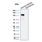 Cadherin 16 Antibody Human and Rat Kidney WB. Western blot analysis of Cadherin-16 / CDH16 expression in kidney tissue lysates using Cadherin 16 antibody clone CDH16/9611R. Lane 1: human kidney lysate, Lane 2: rat kidney lysate. A strong band is detected at approximately 100-110 kDa in human kidney lysate, consistent with the predicted molecular weight of Cadherin-16 (CDH16), with the slightly higher apparent migration reflecting glycosylation of this kidney-restricted adhesion protein. Minimal or no detectable signal is observed in rat kidney lysate under these conditions, indicating preferential detection in human tissue.