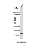 Western blot testing of human A431 cell lysate with recombinant Cystatin A antibody (clone CSTA/9087R). Predicted molecular weight ~11 kDa.