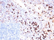 IHC staining of FFPE human tonsil tissue with recombinant Lambda Light Chain antibody (clone IGL/9397R). Inset: PBS used in place of primary Ab (secondary Ab negative control).