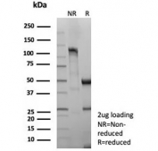 SDS-PAGE analysis of purified recombinant CD8 alpha antibody (clone rCD8/9211) as confirmation of integrity and purity.