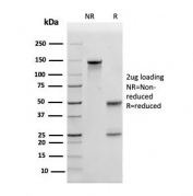 SDS-PAGE analysis of purified, BSA-free APOE antibody (clone APOE/3673) as confirmation of integrity and purity.