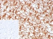 IHC staining of FFPE human brain tissue with recombinant MBP antibody (clone rMBP/9301). Inset: PBS used in place of primary Ab (secondary Ab negative control). HIER: boil tissue sections in pH 9 10mM Tris with 1mM EDTA for 20 min and allow to cool before testing.