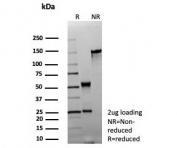 SDS-PAGE analysis of purified recombinant MBP antibody (clone rMBP/9301) as confirmation of integrity and purity.