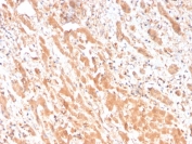 IHC staining of FFPE human liver tissue with Apolipoprotein H antibody (clone APOH/3682). HIER: boil tissue sections in pH 9 10mM Tris with 1mM EDTA for 20 min and allow to cool before testing.