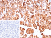 IHC staining of FFPE human pancreas tissue with Colipase antibody (clone CLPS/9026). Inset: PBS used in place of primary Ab (secondary Ab negative control). HIER: boil tissue sections in pH 9 10mM Tris with 1mM EDTA for 20 min and allow to cool before testing.