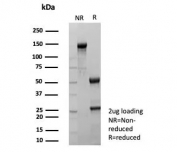 SDS-PAGE analysis of purified, BSA-free recombinant TFF1 antibody (clone rTFF1/9134) as confirmation of integrity and purity.