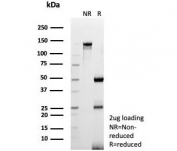 SDS-PAGE analysis of purified, BSA-free CD3 delta antibody (clone CD3D/8898) as confirmation of integrity and purity.
