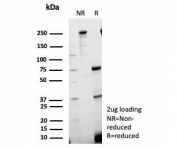 SDS-PAGE analysis of purified, BSA-free Sex Hormone Binding Globulin antibody (clone SHBG/8924) as confirmation of integrity and purity.