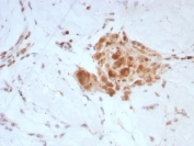 IHC staining of FFPE human testis tissue with Sex Hormone Binding Globulin antibody (clone SHBG/8924). HIER: boil tissue sections in pH 9 10mM Tris with 1mM EDTA for 20 min and allow to cool before testing.