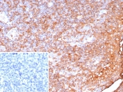 IHC staining of FFPE human tonsil tissue with recombinant HLA-DP/DQ/DR antibody (clone HLA-Pan/9268R). Inset: PBS used in place of primary Ab (secondary Ab negative control). HIER: boil tissue sections in pH 9 10mM Tris with 1mM EDTA for 20 min and allow to cool before testing.