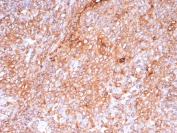 IHC staining of FFPE human tonsil tissue with recombinant HLA-DP/DQ/DR antibody (clone HLA-Pan/9268R). HIER: boil tissue sections in pH 9 10mM Tris with 1mM EDTA for 20 min and allow to cool before testing.