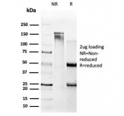 SDS-PAGE analysis of purified, BSA-free Beta Amyloid antibody (clone APP/4469) as confirmation of integrity and purity.